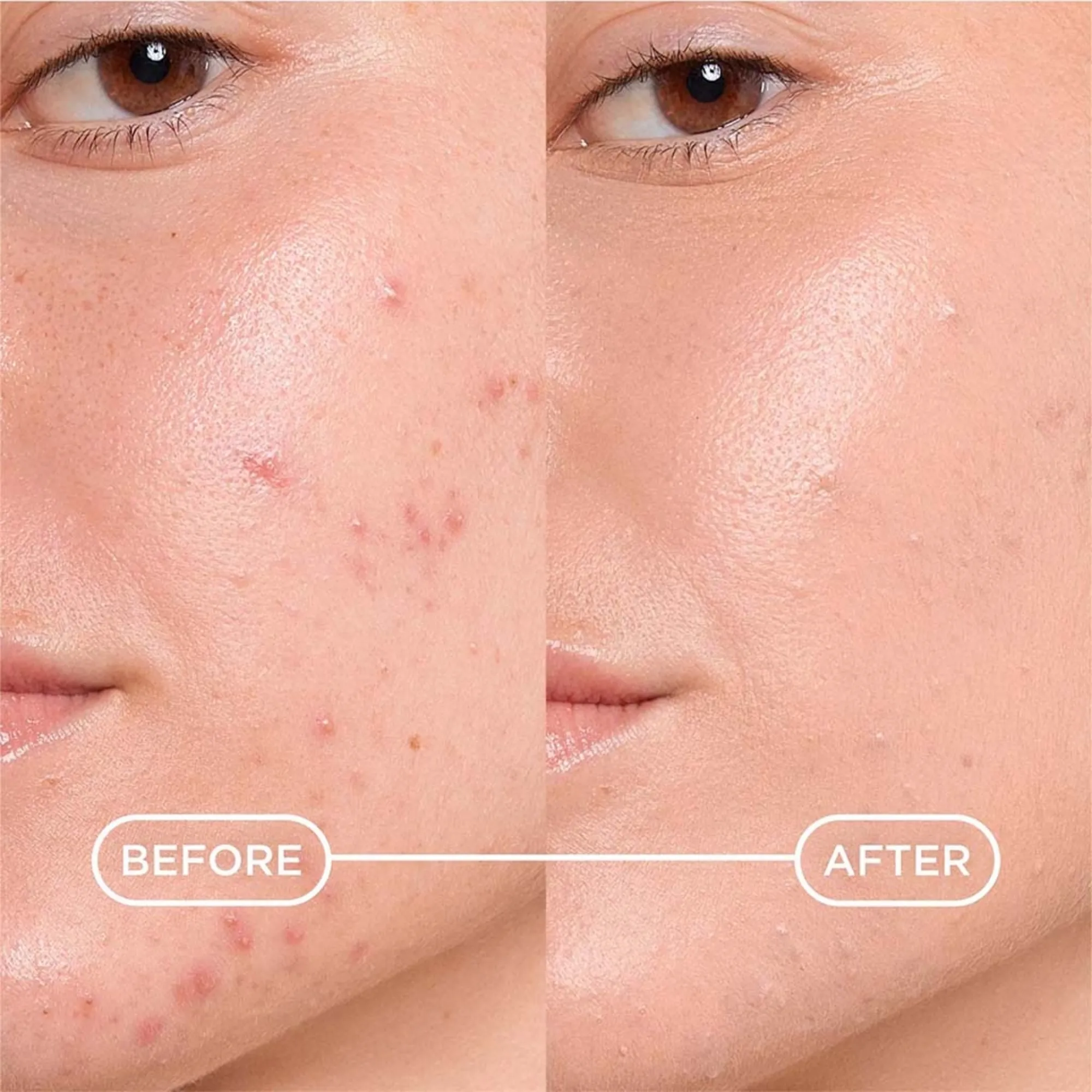 Lyskin-bioderma-sebium-global-cover-intensive-purifying-care-high-coverage-30ml-BDM00017 (4)_result
