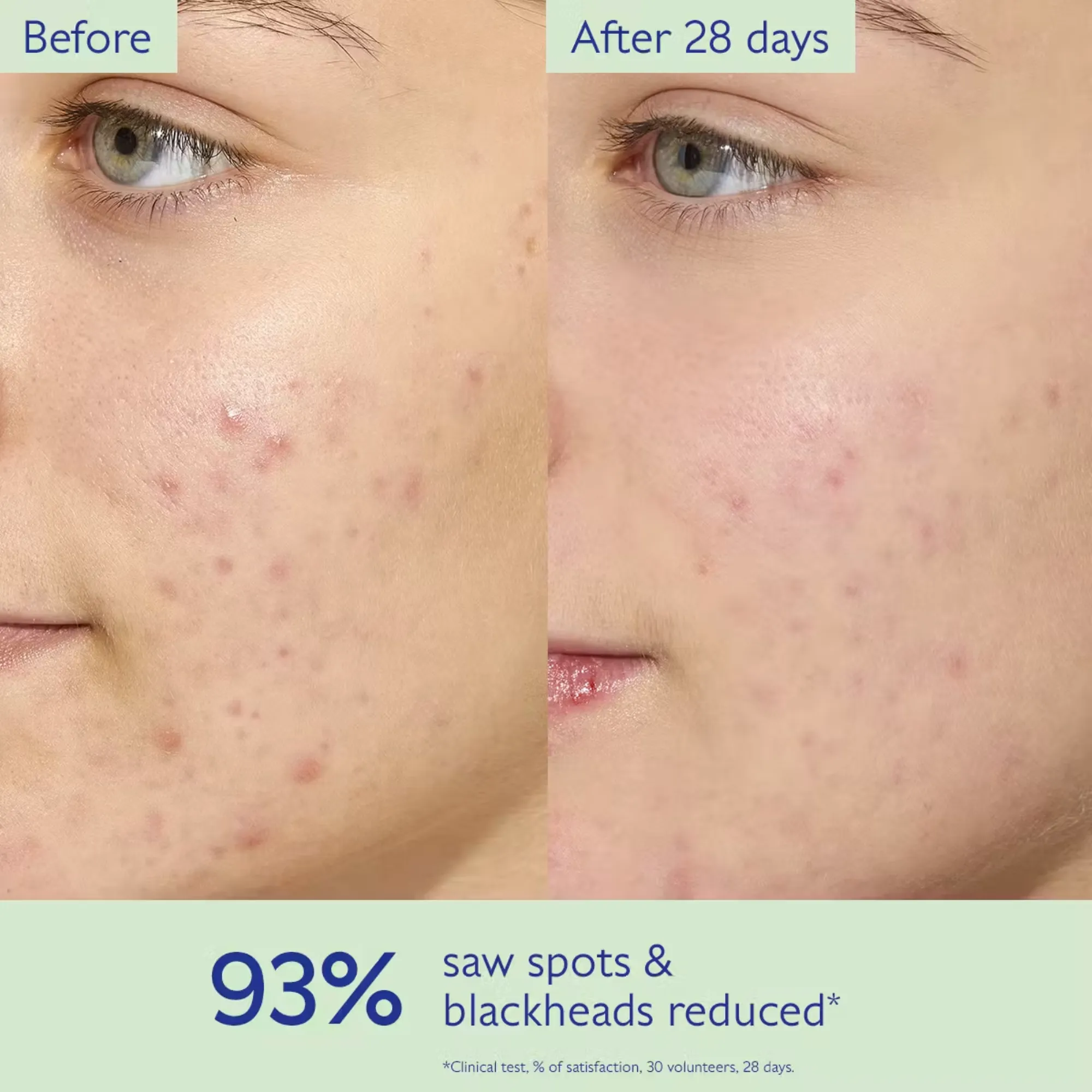 Lyskin-caudalie-vinopure-skin-perfecting-mattifying-fluid-40ml-CDL00118 (2)_resultado