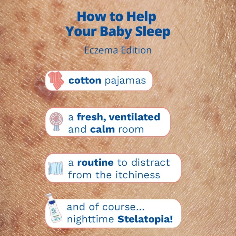 Mustela Stelatopia+ Lipid-Replenishing Cream for Extremely Dry and Atopic-Prone Skin 300ml