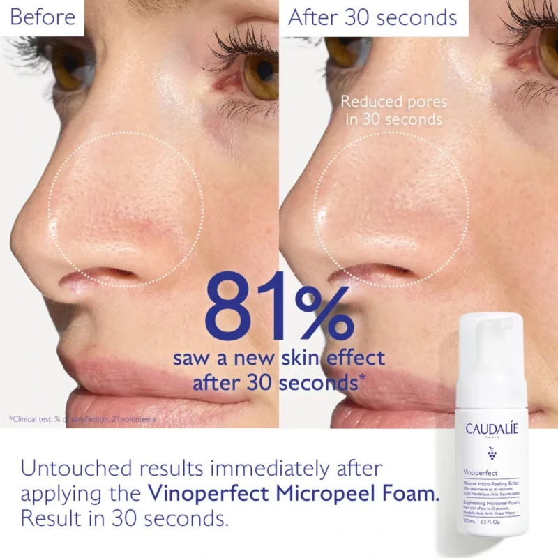Caudalie Vinoperfect Brightening Micropeel Foam 100ml 3.3fl.oz - Before and After