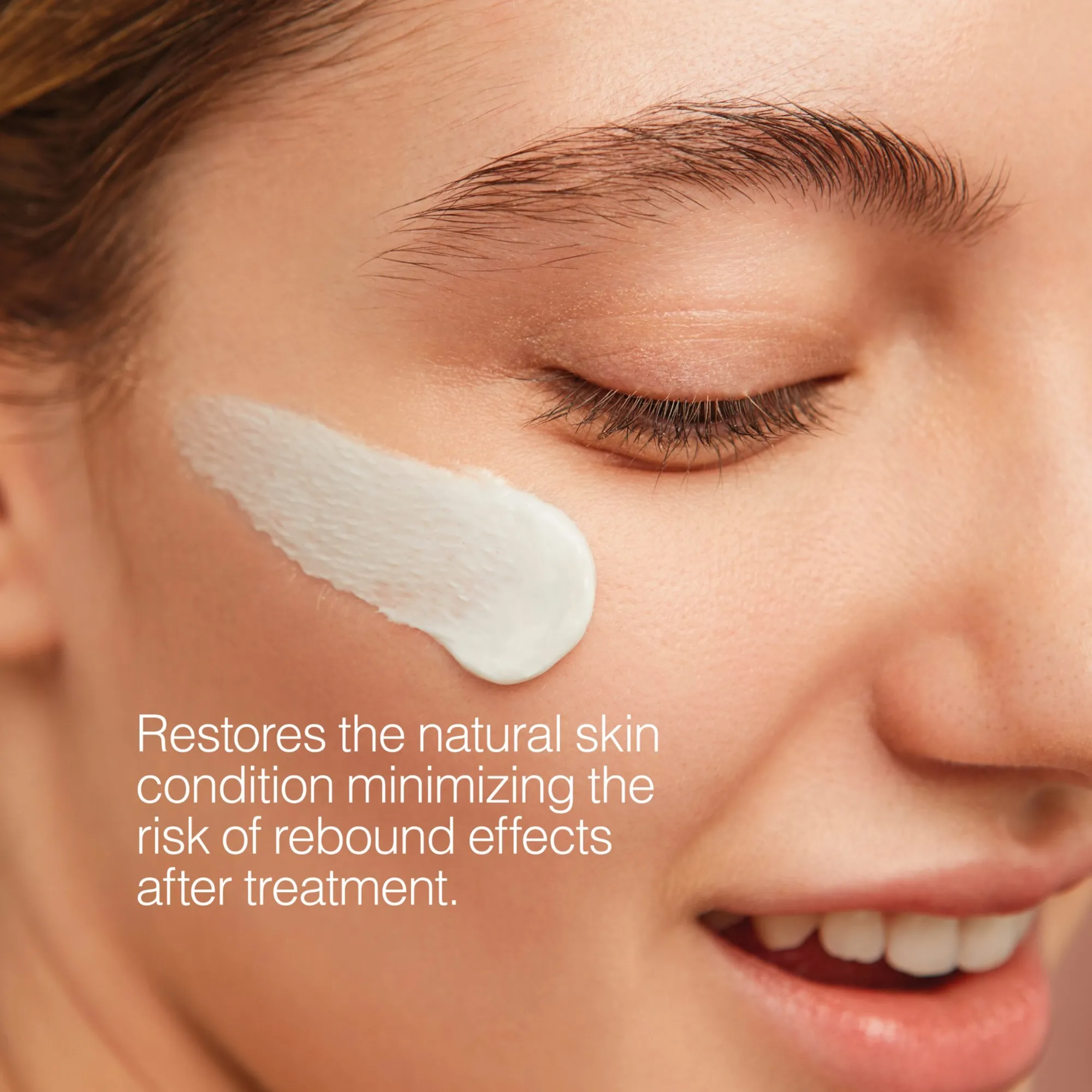 LYSkin-meline-03-restore-soothing-restorative-cream-30g-1-06oz-MEL00009_4_lyskin Meline 03 Restore soothing restorative cream 30g