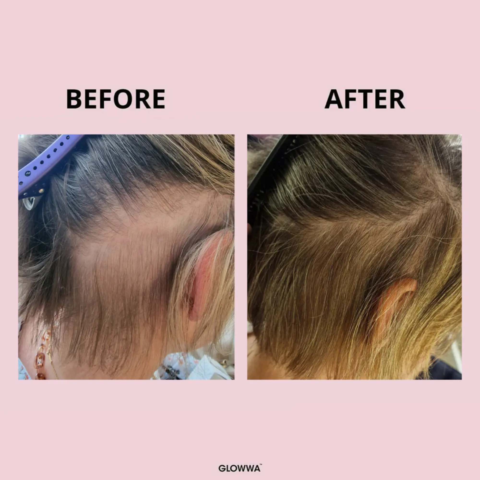 Lyskin-glowwa-hair-food-vitamins-for-healthy-hair-growth-60caplsules-1month-GLW00001 (3)_resultado
