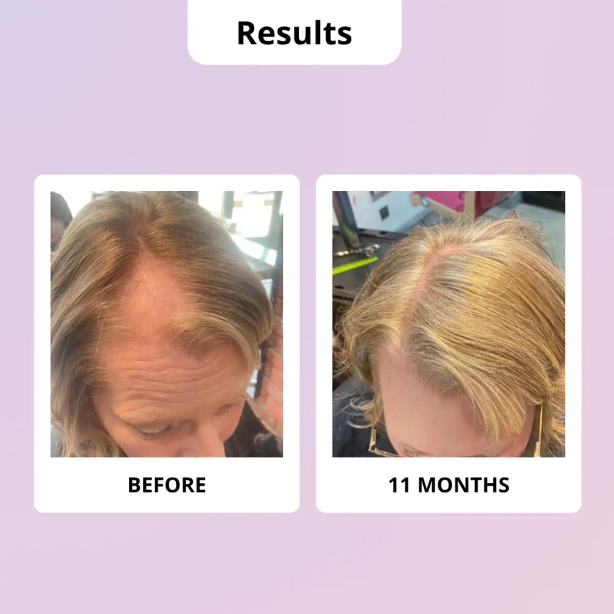 Lyskin-glowwa-meno-hair-food-vitamins-during-menopause-60caplsules-1month-GLW00003 (4)_resultado