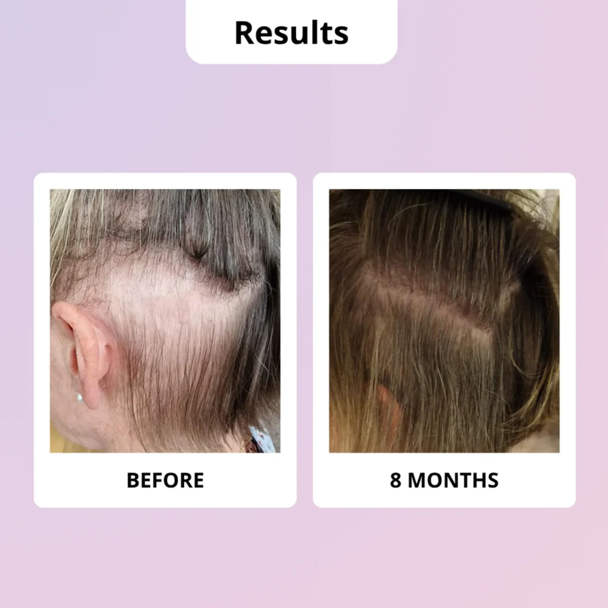 Lyskin-glowwa-meno-hair-food-vitamins-during-menopause-60caplsules-1month-GLW00003 (5)_resultado