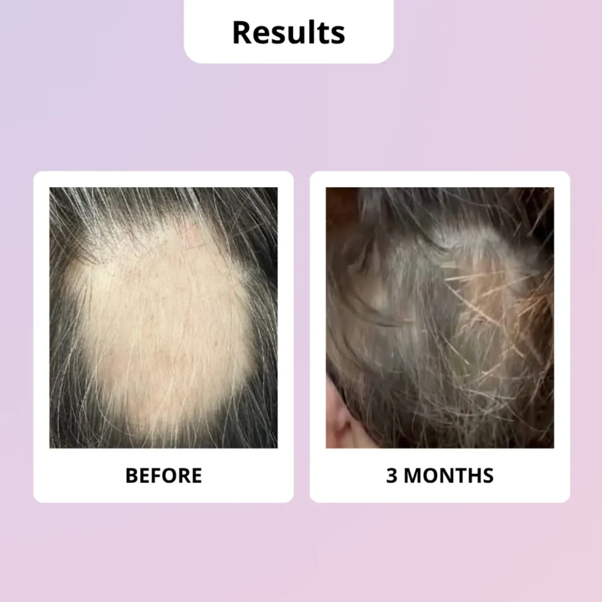 Lyskin-glowwa-meno-hair-food-vitamins-during-menopause-60caplsules-1month-GLW00003 (6)_resultado