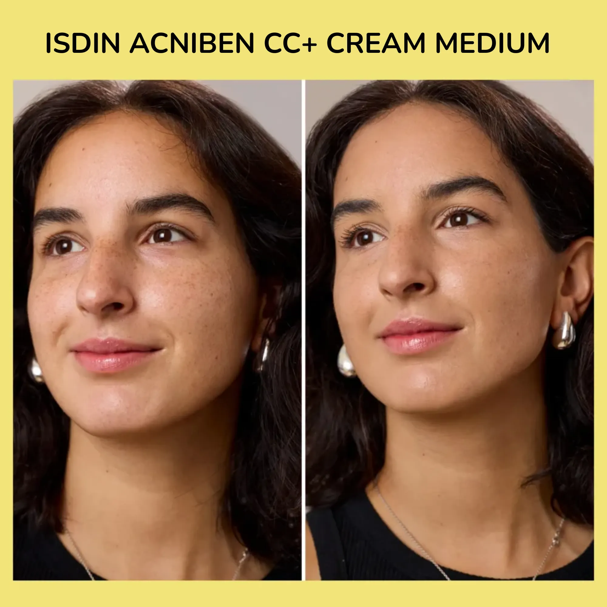 Lyskin-isdin-acniben-cc-cream-40ml (4)_resultado