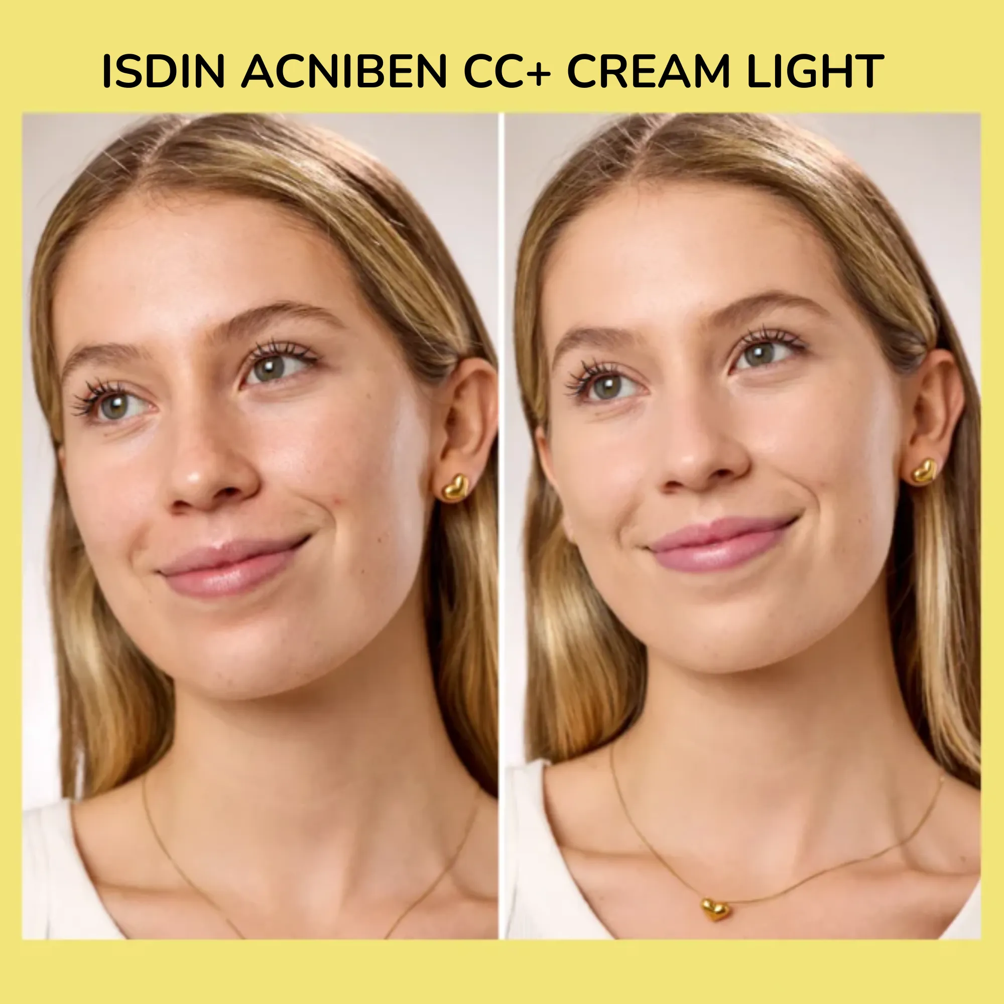 Lyskin-isdin-acniben-cc-cream-40ml (5)_resultado