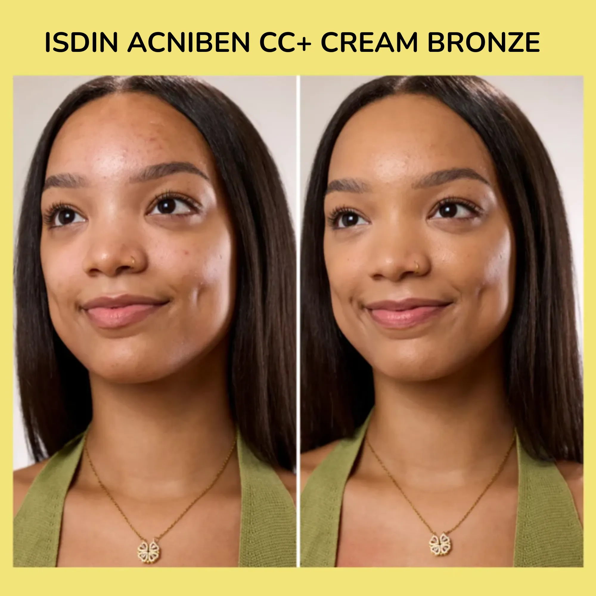 Lyskin-isdin-acniben-cc-cream-40ml (6)_resultado